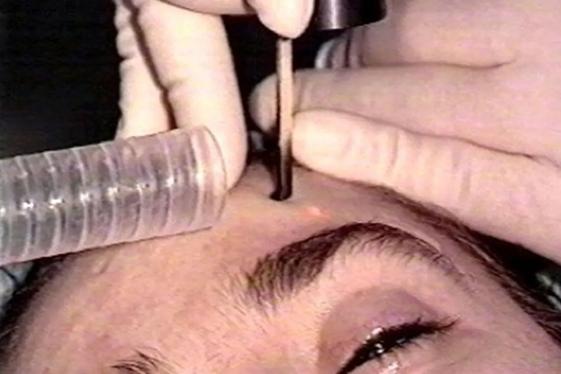Gesichtschirurgie Berlin Narben Kopf Hals Bereich